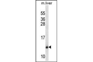 Western blot analysis of SEC61B Antibody (Center) Cat. (SEC61B Antikörper  (Middle Region))