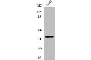 Western Blot analysis of Jurkat cells using Ephrin-A3 Polyclonal Antibody (Ephrin A3 Antikörper  (C-Term))