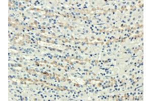 Immunohistochemical staining of rat stomach using anti-Complement receptors 1&2 antibody  Formalin fixed rat stomach slices were were stained with  at 3 µg/ml.