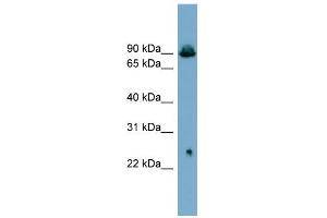WB Suggested Anti-SLC6A5 Antibody Titration:  0.