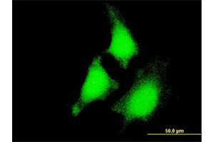 Immunofluorescence of monoclonal antibody to MAP2K5 on HeLa cell. (MAP2K5 Antikörper  (AA 1-120))