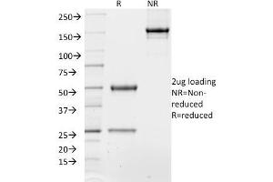 SDS-PAGE Analysis of Purified TCF4 Mouse Monoclonal Antibody (TCF4/1705). (TCF4 Antikörper  (AA 365-671))