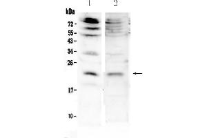 Western blot analysis of KGF using anti-KGF antibody .