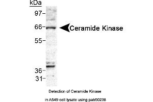 Image no. 1 for anti-Ceramide Kinase (CERK) (AA 50-150) antibody (ABIN363547) (CERK Antikörper  (AA 50-150))