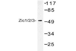 Western blot (WB) analysis of Zic1/2/3 antibody in extracts from Jurkat cells.