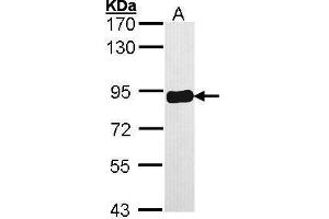 WB Image Sample (30 ug of whole cell lysate) A: A431 , 7. (PRKCSH Antikörper)