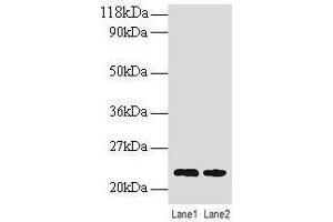 Western blot All lanes: TAGLN antibody at 2 μg/mL Lane 1: EC109 whole cell lysate Lane 2: 293T whole cell lysate Secondary Goat polyclonal to rabbit IgG at 1/15000 dilution Predicted band size: 23 kDa Observed band size: 23 kDa (Transgelin Antikörper  (AA 2-201))