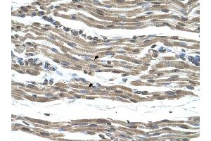 COX15 antibody was used for immunohistochemistry at a concentration of 4-8 ug/ml to stain Skeletal muscle cells (arrows) in Human Muscle. (COX15 Antikörper)