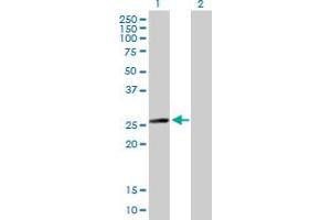 Western Blot analysis of MYL6B expression in transfected 293T cell line by MYL6B MaxPab polyclonal antibody. (MYL6B Antikörper  (AA 1-208))