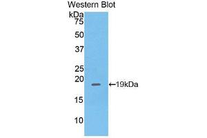 Western blot analysis of the recombinant protein. (PHLDA2 Antikörper  (AA 9-140))