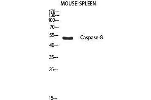 Western Blot (WB) analysis of Mouse Spleen using Cleaved-Caspase-8 p18 (S217) antibody. (Caspase-8 p18 Antikörper  (cleaved, Ser217))