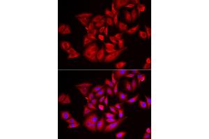 Immunofluorescence analysis of U2OS cells using TLK2 antibody. (TLK2 Antikörper)