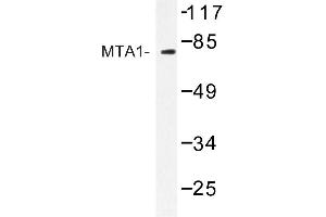 Image no. 1 for anti-Metastasis Associated 1 (MTA1) antibody (ABIN272222) (MTA1 Antikörper)