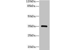 Western blot All lanes: STX19 antibody at 2 μg/mL + K562 whole cell lysate Secondary Goat polyclonal to rabbit IgG at 1/10000 dilution Predicted band size: 35 kDa Observed band size: 35 kDa (Syntaxin 19 Antikörper  (AA 1-140))