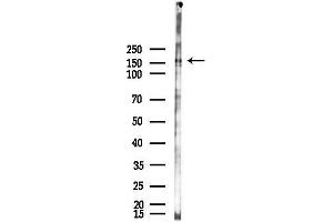 anti-Ubiquitin Specific Peptidase 47 (USP47) antibody
