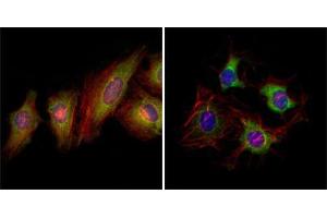 Immunofluorescence analysis of Hela (left) and HepG2 (right) cells using EphB2 mouse mAb (green).