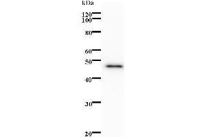 Western Blotting (WB) image for anti-B Double Prime 1, Subunit of RNA Polymerase III Transcription Initiation Factor IIIB (BDP1) antibody (ABIN931198)
