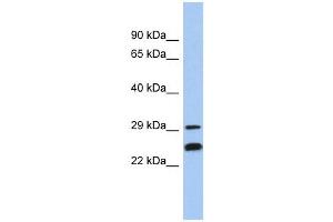 NSMCE2 antibody used at 1 ug/ml to detect target protein. (NSMCE2 Antikörper)