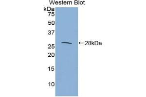 Western blot analysis of the recombinant protein. (IL27 Receptor alpha Antikörper  (AA 123-343))
