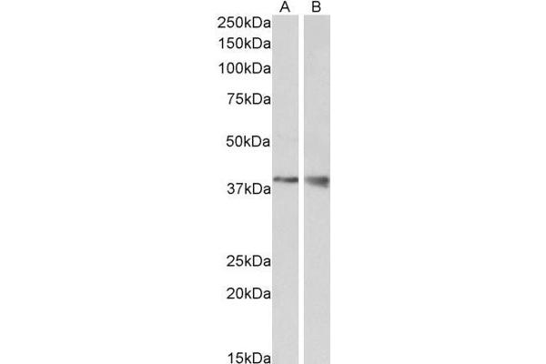 WNT9B Antikörper  (Internal Region)