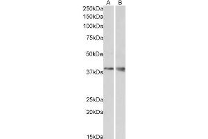 ABIN571005 (1µg/ml) staining of Mouse Kidney (A) and Brain (B) lysate (35µg protein in RIPA buffer). (WNT9B Antikörper  (Internal Region))