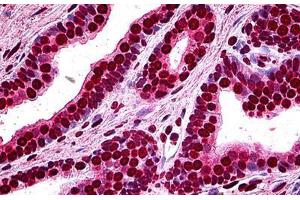 Human Prostate: Formalin-Fixed, Paraffin-Embedded (FFPE) (MEF2A Antikörper  (AA 71-170))