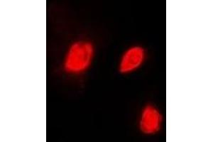 Immunofluorescent analysis of EID1 staining in HeLa cells. (EID1 Antikörper)