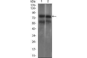 Western blot analysis using GUCY1A3 mouse mAb against HEK293 (1) and Jurkat (2) cell lysate.