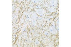 Immunohistochemistry of paraffin-embedded mouse spinal cord using CNP antibody.