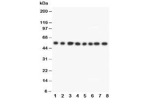 Western Blotting (WB) image for anti-Dihydrolipoamide Dehydrogenase (DLD) (C-Term) antibody (ABIN3030730)
