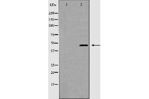 Western blot analysis of CRFR2 expression in K562 cells. (CRHR2 Antikörper  (Internal Region))