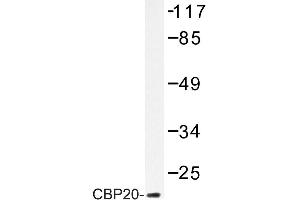 Image no. 1 for anti-Nuclear Cap Binding Protein Subunit 2 (NCBP2) antibody (ABIN272203) (NCBP2 Antikörper)
