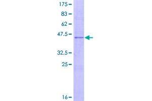 Image no. 1 for Interleukin 17B (IL17B) (AA 1-180) protein (GST tag) (ABIN1307705) (IL17B Protein (AA 1-180) (GST tag))