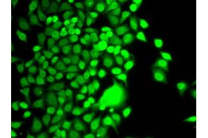 Immunofluorescence (IF) image for anti-Histone Acetyltransferase 1 (HAT1) antibody (ABIN1882320) (HAT1 Antikörper)