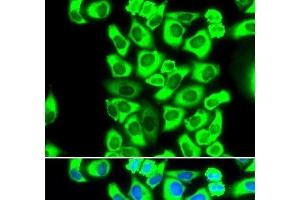 Immunofluorescence analysis of MCF-7 cells using RPS3A Polyclonal Antibody (RPS3A Antikörper)