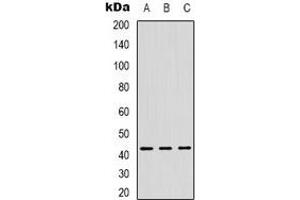 Western blot analysis of ZNF24 expression in Hela (A), Jurkat (B), HUVEC (C) whole cell lysates.