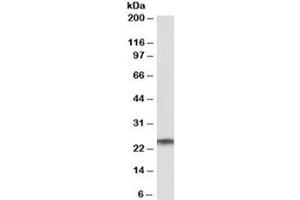 Western blot testing of human testis lysate with RAN antibody at 1ug/ml. (RAN Antikörper)