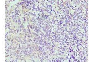 Immunohistochemistry of paraffin-embedded human tonsil tissue using ABIN7156622 at dilution of 1:100 (IRF4 Antikörper  (AA 180-451))