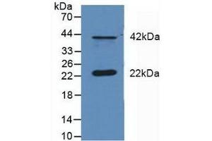 Detection of DUSP6 in Mouse Cerebellum Tissue using Polyclonal Antibody to Dual Specificity Phosphatase 6 (DUSP6) (DUSP6 Antikörper  (AA 1-300))