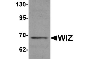 Western Blotting (WB) image for anti-Zinc Finger Protein 803 (ZNF803) (C-Term) antibody (ABIN1030802)