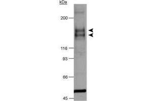 Western blot analysis of Flt1 in chimeric CSF-1R/VEGFR-2 detection in transfected lysates using Flt1 polyclonal antibody . (FLT1 Antikörper  (AA 800-900))