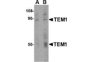 Western Blotting (WB) image for anti-CD248 Molecule, Endosialin (CD248) (C-Term) antibody (ABIN1030727)