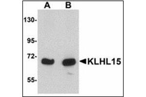 Western blot analysis of KLHL15 in HeLa cell lysate with KLHL15 antibody at (A) 1 and (B) 2 µg/ml. (KLHL15 Antikörper  (C-Term))