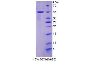 SDS-PAGE (SDS) image for Keratin 7 (KRT7) (AA 91-394) protein (His tag) (ABIN1080160)