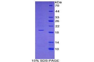 SDS-PAGE (SDS) image for TSC22 Domain Family, Member 3 (TSC22D3) (AA 1-134) protein (His tag) (ABIN2124606)