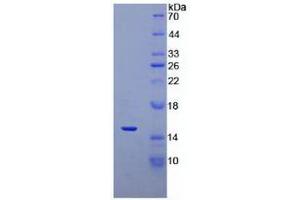 SDS-PAGE analysis of recombinant Human DEFa5. (DEFA5 Protein)