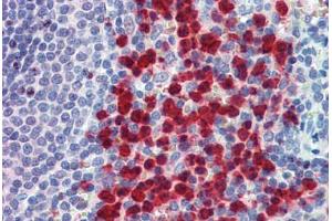 Human Spleen: Formalin-Fixed, Paraffin-Embedded (FFPE) (Cell Adhesion Molecule 4 Antikörper  (AA 370-384))