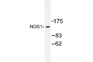 Image no. 1 for anti-Nitric Oxide Synthase 1, Neuronal (NOS1) antibody (ABIN272121) (NOS1 Antikörper)