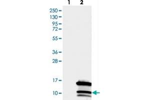 Western blot analysis of Lane 1: Negative control (vector only transfected HEK293T lysate), Lane 2: Over-expression Lysate (Co-expressed with a C-terminal myc-DDK tag (~3. (CCDC23 Antikörper)