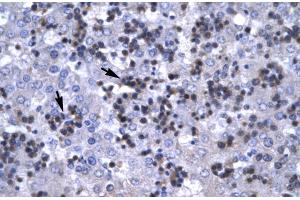 Immunohistochemistry (IHC) image for anti-Recombination Signal Binding Protein For Immunoglobulin kappa J Region (RBPJ) (C-Term) antibody (ABIN2777213)